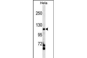 FC Antibody (C-term) (ABIN1537556 and ABIN2849534) western blot analysis in Hela cell line lysates (35 μg/lane). (FAM65C anticorps  (C-Term))