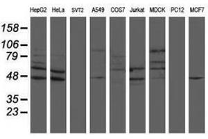 anti-SUMO1/sentrin/SMT3 Specific Peptidase 2 (SENP2) (AA 139-523) antibody