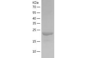 Western Blotting (WB) image for Chloride Channel, Nucleotide-Sensitive, 1A (CLNS1A) (AA 1-237) protein (His-IF2DI Tag) (ABIN7122350)