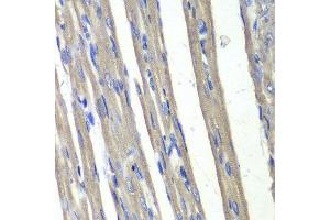 Immunohistochemistry (IHC) image for anti-Aldo-Keto Reductase Family 1, Member C3 (3-alpha Hydroxysteroid Dehydrogenase, Type II) (AKR1C3) (AA 1-323) antibody (ABIN3022536)