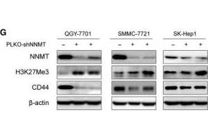 NNMT regulates intracellular methylation potential and CD44 transcription by inhibiting histone H3K27 methylation. (Histone 3 anticorps  (H3K27me))