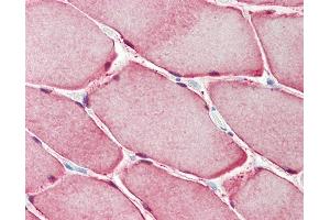 Anti-CA3 / Carbonic Anhydrase III antibody IHC staining of human skeletal muscle.