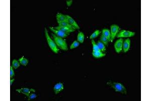 Immunofluorescent analysis of HepG2 cells cells using ABIN7174258 at dilution of 1:100 and Alexa Fluor 488-congugated AffiniPure Goat Anti-Rabbit IgG(H+L)