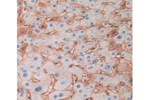 Used in DAB staining on fromalin fixed paraffin- embedded liver tissue