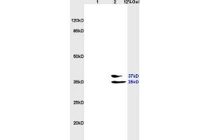 L1 rat heart, L2 rat brain lysates probed (ABIN687592) at 1:200 in 4 °C. (EpCAM anticorps  (AA 221-314))