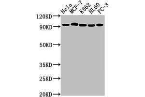 Western Blot Positive WB detected in: Hela whole cell lysate, MCF-7 whole cell lysate, K562 whole cell lysate, HL60 whole cell lysate, PC-3 whole cell lysate All lanes: TOP1 antibody at 1:2000 Secondary Goat polyclonal to rabbit IgG at 1/50000 dilution Predicted band size: 91 kDa Observed band size: 91 kDa (Recombinant Topoisomerase I anticorps)
