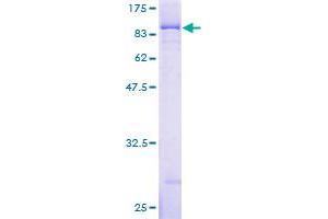 Image no. 1 for Insulin-Like Growth Factor 2 mRNA Binding Protein 3 (IGF2BP3) (AA 1-579) protein (GST tag) (ABIN7540268)