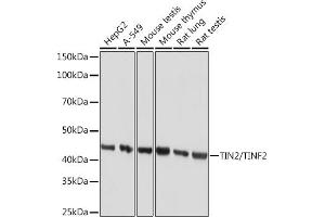 Western blot analysis of extracts of various cell lines, using TIN2/TINF2 Rabbit mAb (ABIN7270771) at 1:1000 dilution. (TINF2 anticorps)