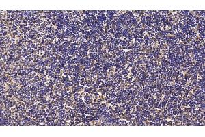 Detection of Surv in Human Lymph node Tissue using Monoclonal Antibody to Survivin (Surv) (Survivin anticorps  (AA 1-142))