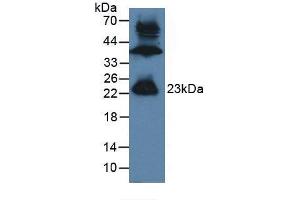 Figure. (GREM1 anticorps  (AA 26-184))