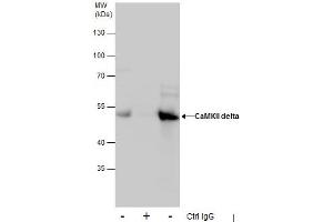 IP Image Immunoprecipitation of CaMKII delta protein from HepG2 whole cell extracts using 5 μg of CaMKII delta antibody, Western blot analysis was performed using CaMKII delta antibody, EasyBlot anti-Rabbit IgG  was used as a secondary reagent. (CAMK2D anticorps)