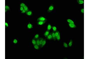 Immunofluorescence staining of HepG2 cells with ABIN7144468 at 1:530, counter-stained with DAPI. (AEN anticorps  (AA 117-325))