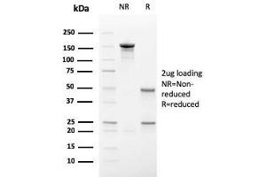 SDS-PAGE Analysis Purified Secretory Component Mouse Monoclonal Antibody (SC-05).
