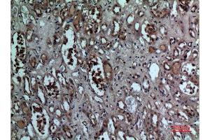 Immunohistochemistry (IHC) analysis of paraffin-embedded Human Kidney, antibody was diluted at 1:100. (BNIP3 anticorps  (Internal Region))
