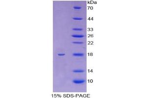 SDS-PAGE analysis of Human KIF5A Protein. (KIF5A Protéine)