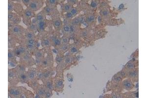 Detection of ASGR1 in Mouse Liver Tissue using Polyclonal Antibody to Asialoglycoprotein Receptor 1 (ASGR1)