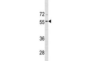 BMP8A antibody western blot analysis in CEM lysate (BMP8A anticorps  (AA 271-298))
