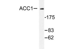 Image no. 1 for anti-Acetyl-CoA Carboxylase alpha (ACACA) antibody (ABIN271865) (Acetyl-CoA Carboxylase alpha anticorps)