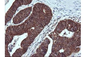 Immunohistochemistry (IHC) image for anti-Acetyl-CoA Acyltransferase 2 (ACAA2) antibody (ABIN1495727) (ACAA2 anticorps)