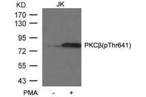 Western blot analysis of extracts from JK cells untreated or treated with PMA using PKCβ (phospho-Thr641) antibody. (PKC beta anticorps  (pThr641))