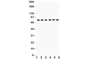 Western blot testing of tPA antibody and Lane 1:  mouse lung;  2: (m) testis; and human samples  3: U87;  4: A431;  5: A375;  6: A549 lysate (PLAT anticorps  (AA 366-562))