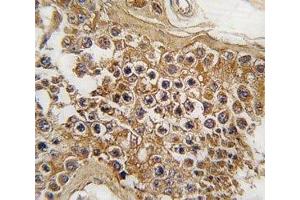 IHC analysis of FFPE human testis tissue stained with ALK antibody