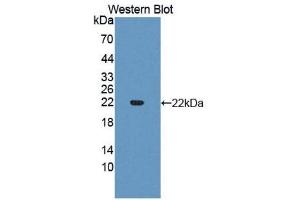 Western Blotting (WB) image for anti-Slit Homolog 3 (SLIT3) antibody (Biotin) (ABIN1176109)