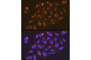 Immunofluorescence analysis of U-2 OS cells using TGN46/TGOLN2 Rabbit mAb (ABIN7270875) at dilution of 1:100 (40x lens).