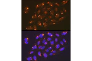 Immunofluorescence analysis of U-2 OS cells using TGN46/TGOLN2 Rabbit mAb (ABIN7270875) at dilution of 1:100 (40x lens). (TGOLN2 anticorps)