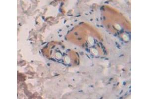 Used in DAB staining on fromalin fixed paraffin- embedded Kidney tissue (IL1F10 anticorps  (AA 15-152))