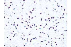 Immunohistochemistry of paraffin-embedded rat brain using NUM Rabbit mAb (ABIN7269002) at dilution of 1:100 (40x lens).