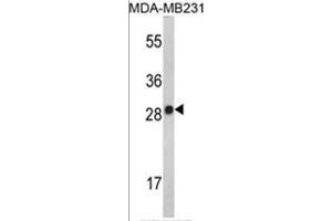Western blot analysis of AP17501PU-N IL2 Antibody (Center) in MDA-MB231 cell line lysates (35 µg/lane). (IL-2 anticorps  (AA 57-86))