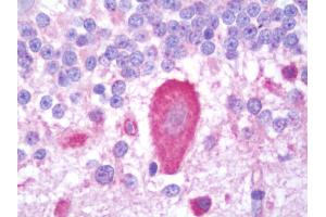 Anti-ITPR3 / IP3R antibody IHC staining of human brain, cerebellum.