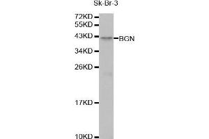 Western Blotting (WB) image for anti-Biglycan (BGN) (AA 20-230) antibody (ABIN1678858)
