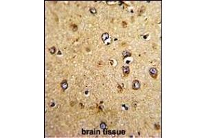Formalin-fixed and paraffin-embedded human brain tissue with HOMER3 Antibody (Center), which was peroxidase-conjugated to the secondary antibody, followed by DAB staining.