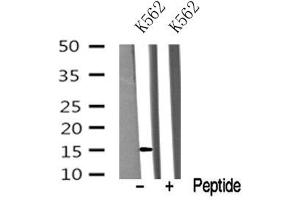 Western blot analysis of VAMP4 in lysates of K562? (VAMP4 anticorps  (N-Term))