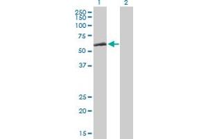 Western Blot analysis of CCT8 expression in transfected 293T cell line by CCT8 MaxPab polyclonal antibody.