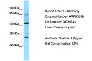 Image no. 1 for anti-Tafazzin (TAZ) (AA 192-241) antibody (ABIN6749979) (TAZ anticorps  (AA 192-241))
