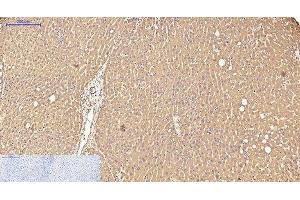 Immunohistochemistry of paraffin-embedded Human liver tissue using Transferrin Monoclonal Antibody at dilution of 1:200.