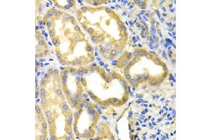 Immunohistochemistry of paraffin-embedded human kidney using DPYD antibody at dilution of 1:100 (x400 lens). (DPYD anticorps)