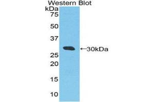 Western Blotting (WB) image for anti-DEAD (Asp-Glu-Ala-Asp) Box Polypeptide 58 (DDX58) (AA 550-776) antibody (ABIN1860445) (DDX58 anticorps  (AA 550-776))