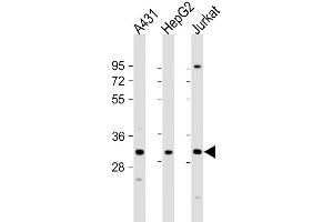 Western Blot at 1:1000 dilution Lane 1: A431 whole cell lysate Lane 2: HepG2 whole cell lysate Lane 3: Jurkat whole cell lysate Lysates/proteins at 20 ug per lane. (LY6G6F anticorps  (N-Term))