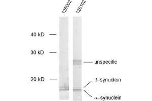 dilution: 1 : 1000, sample: crude synaptosomal fraction of rat brain (P2) (Alpha, beta Synuclein (AA 2-25), (N-Term) anticorps)