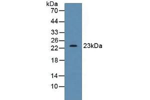 Detection of SDF2 in Human HepG2 Cells using Polyclonal Antibody to Stromal Cell Derived Factor 2 (SDF2)
