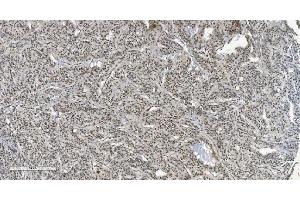 IHC analysis of HP1 alpha/CBX5 using anti-HP1 alpha/CBX5 antibody (ABIN7599057). (CBX5 anticorps  (AA 1-191))