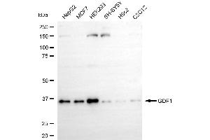 anti-Growth Differentiation Factor 1 (GDF1) antibody