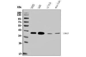 Western blot analysis of ARG2 using anti-ARG2 antibody (ABIN7601717).