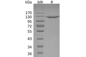 Western Blotting (WB) image for Vascular Cell Adhesion Molecule 1 (VCAM1) protein (Fc Tag) (ABIN7320757)