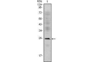 Western blot analysis using CD3E mouse mAb against Jurkat (1) cell lysate. (CD3 epsilon anticorps)