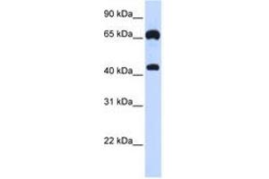Image no. 1 for anti-Guanylate Cyclase 1, Soluble, beta 3 (GUCY1B3) (AA 180-229) antibody (ABIN6740948) (GUCY1B3 anticorps  (AA 180-229))